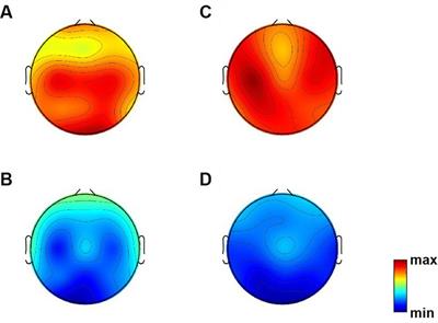 Electroencephalography characteristics related to risk of sudden unexpected death in epilepsy in patients with Dravet syndrome